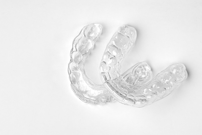 インビザラインGoの注意点