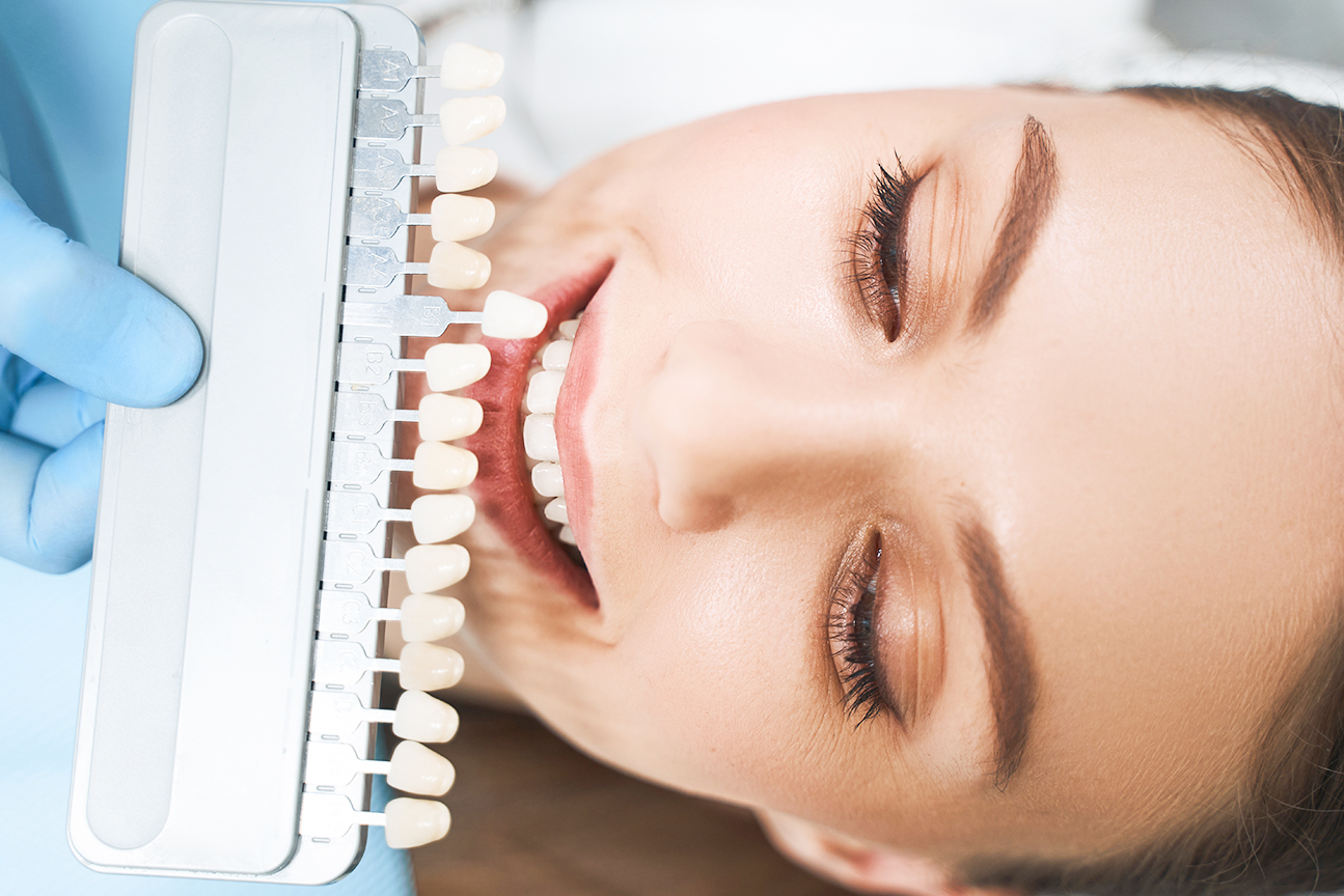 当クリニックのホワイトニングが選ばれる理由